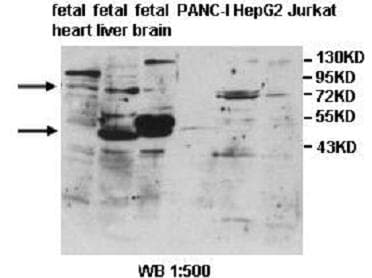 ALG9 Antibody (aa435-618)
