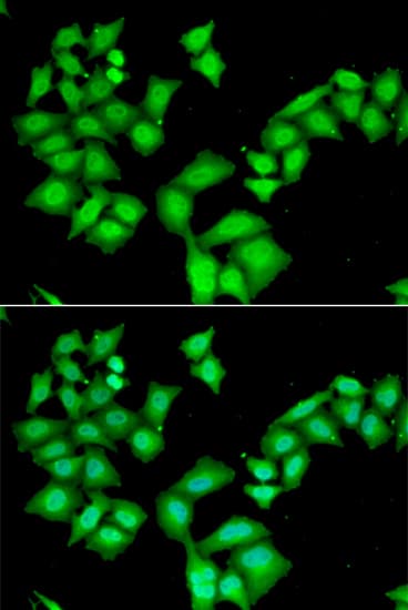 AAAS / Adracalin Antibody