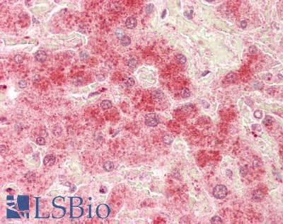 Polyclonal Rabbit anti-Mouse SUV420H1 Antibody (C-Terminus, IHC, WB)