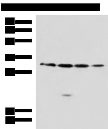 RCHY1 / PIRH2 Antibody