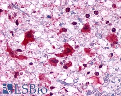 PathPlus™ P2RY6 / P2Y6 Antibody (C-Terminus)