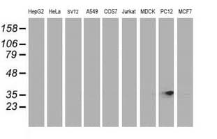 RDH14 Antibody (clone OTI1A7)