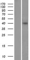 Human IL1RL1 Protein (Over-Expression Lysate Myc-DDK (Flag))