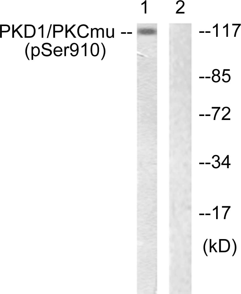PRKD1 / PKC Mu Antibody (phospho-Ser910)