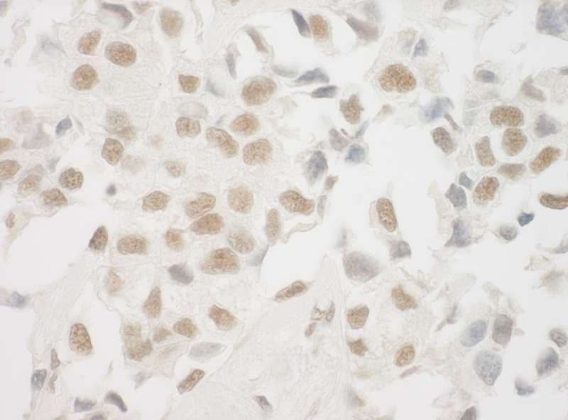 XRCC6 / Ku70 Antibody (aa559-609)