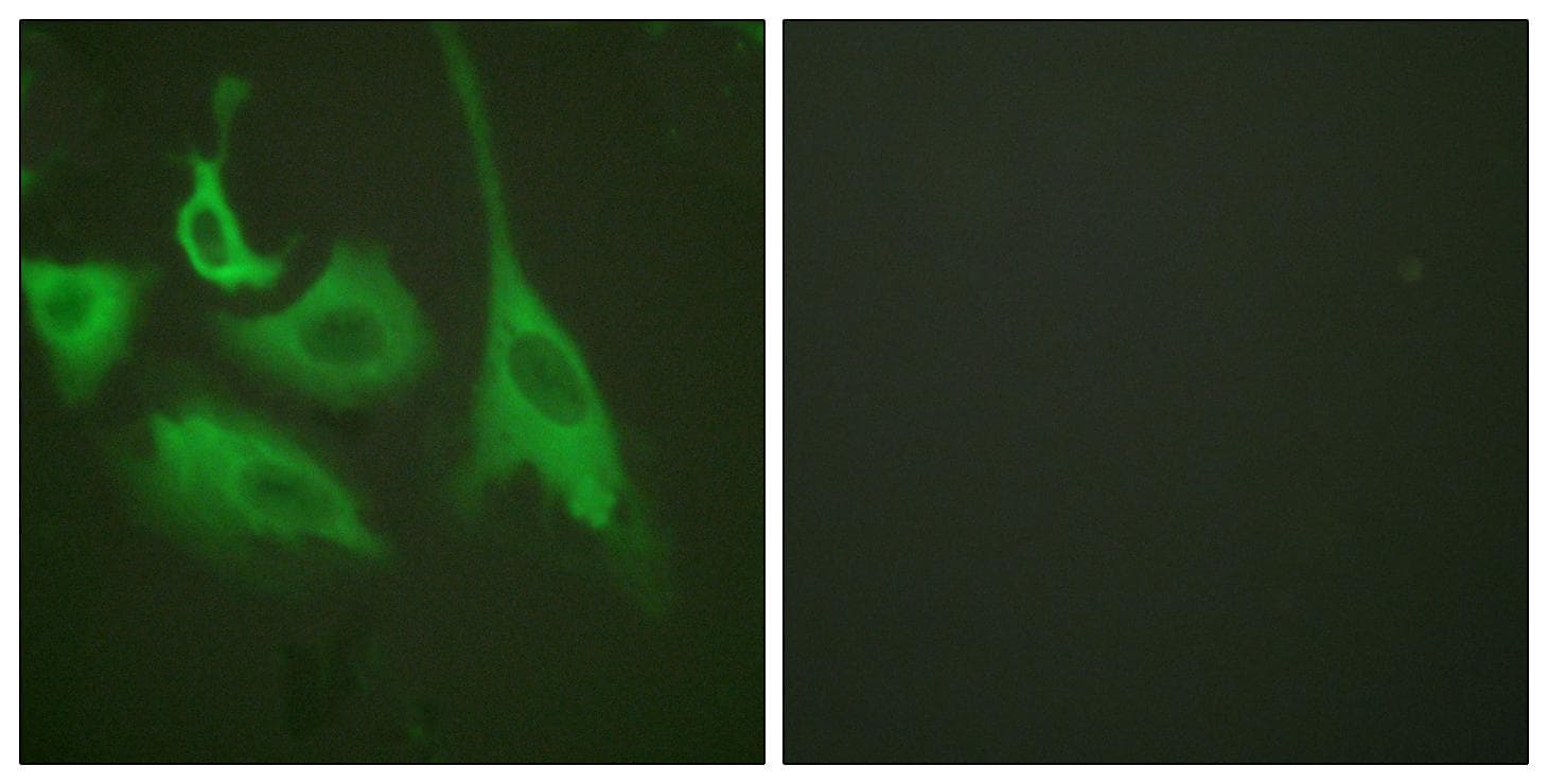 NFKBIB / IKB Beta / IKBB Antibody (phospho-Ser23)