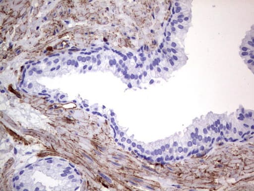 Monoclonal Mouse anti-Human MCAM / CD146 Antibody (clone UMAB155, Carrier-free, IHC, WB)