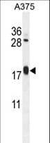 ARL8A Antibody (aa116-142)
