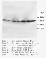 IHC-plus™ Polyclonal Rabbit anti-Human CD40L Antibody (N-Terminus, IHC, WB)