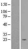 CIB1 / KIP Protein (Over-Expression Lysate Myc-DDK (Flag))