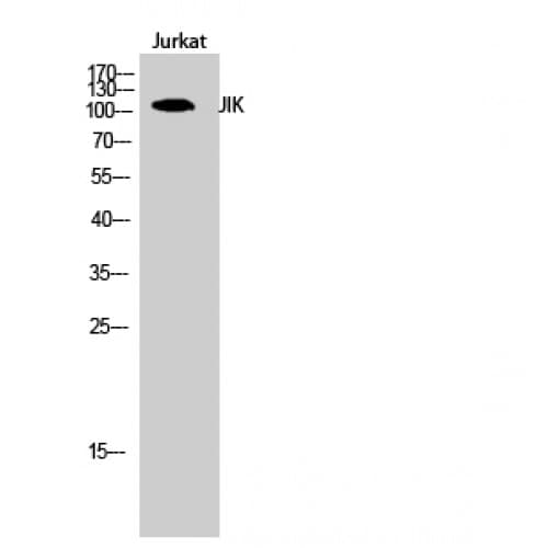 Polyclonal Rabbit anti-Human TAOK3 / JIK Antibody (500-580 aa, Internal, WB)