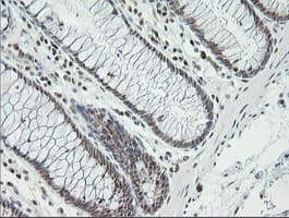 ERCC1 Antibody (clone 2.00E+12)