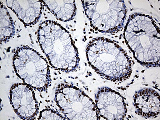 Monoclonal Mouse anti-Human DDX39B / UAP56 Antibody (clone OTI7H4, Carrier-free, aa319-428, IHC, WB)