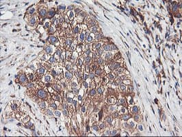 ENPEP / Aminopeptidase A Antibody (clone OTI3E7)