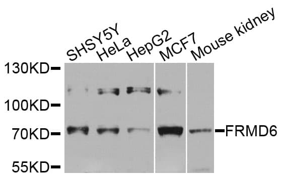FRMD6 Antibody