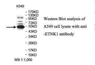 ETNK1 / Ethanolamine Kinase 2 Antibody (aa270-452)