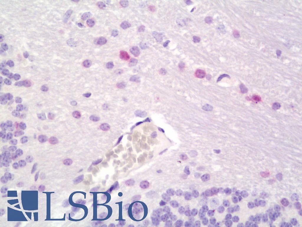 PathPlus™ Polyclonal Rabbit anti-Mouse OLIG1 Antibody (IHC, WB)