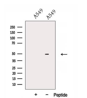 DNASE2B Antibody