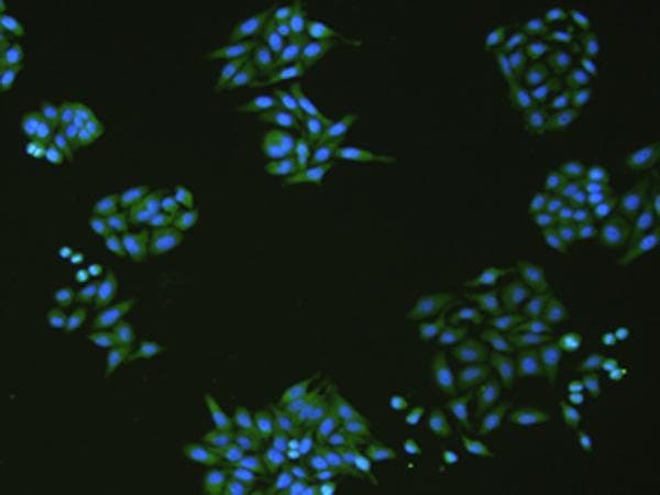 SLC18A3 / VACHT Antibody