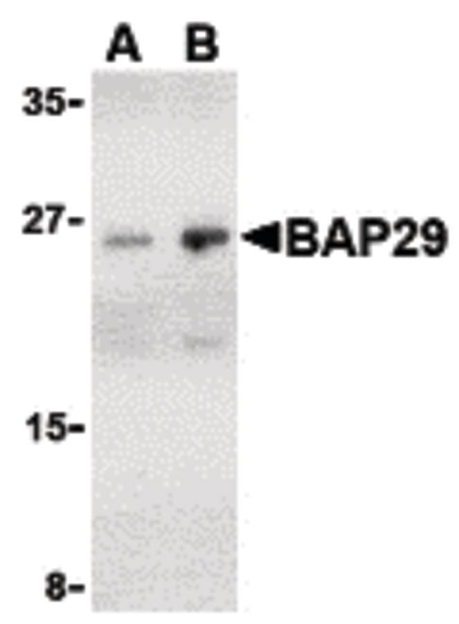 BAP29 / BCAP29 Antibody