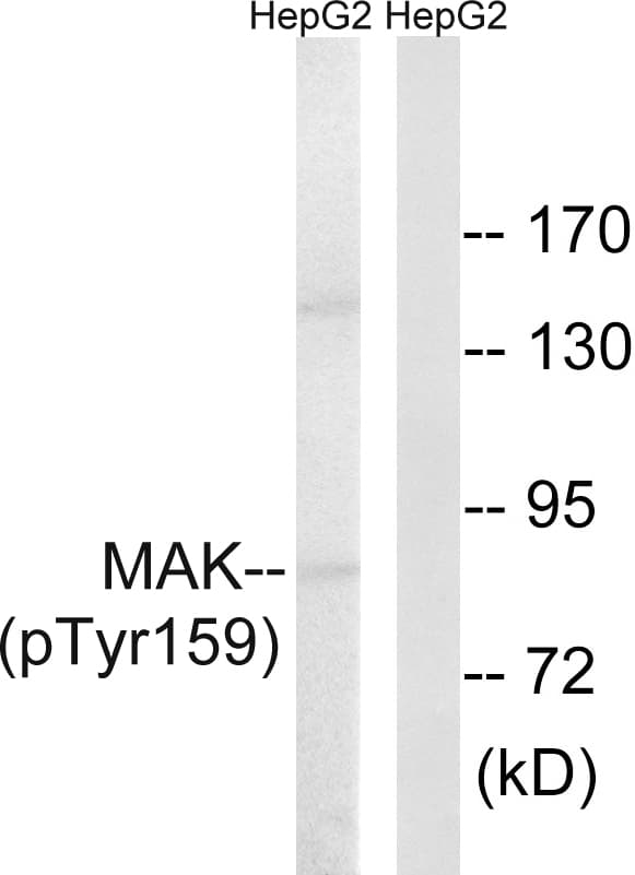 Polyclonal Rabbit anti-Human MAK Antibody (phospho-Tyr159, WB)