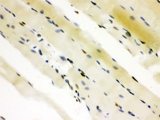CTBP2 Antibody
