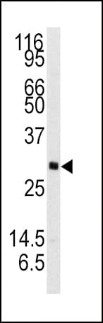 NTF3 / Neurotrophin 3 Antibody (aa152-184)