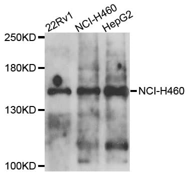IHC-plus™ COL4A5 / Collagen IV Alpha5 Antibody