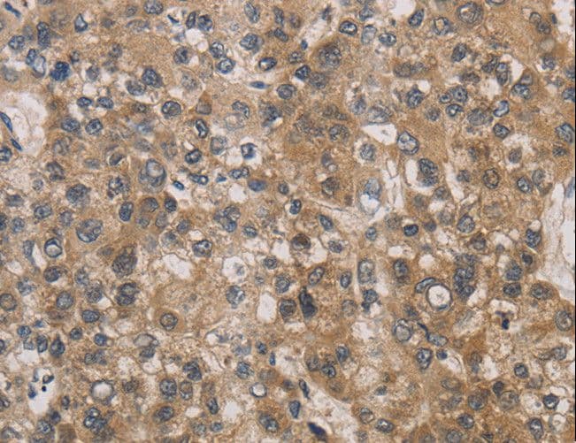 DEGS1 Antibody