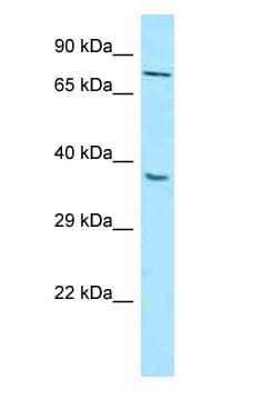 Polyclonal Rabbit anti-Human MTNR1B / MT2 Antibody (N-Terminus, WB)