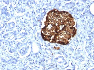 Recombinant Monoclonal Rabbit anti-Human CHGA / Chromogranin A Antibody (clone CHGA/1815R, Azide-free,Carrier-free, IHC)