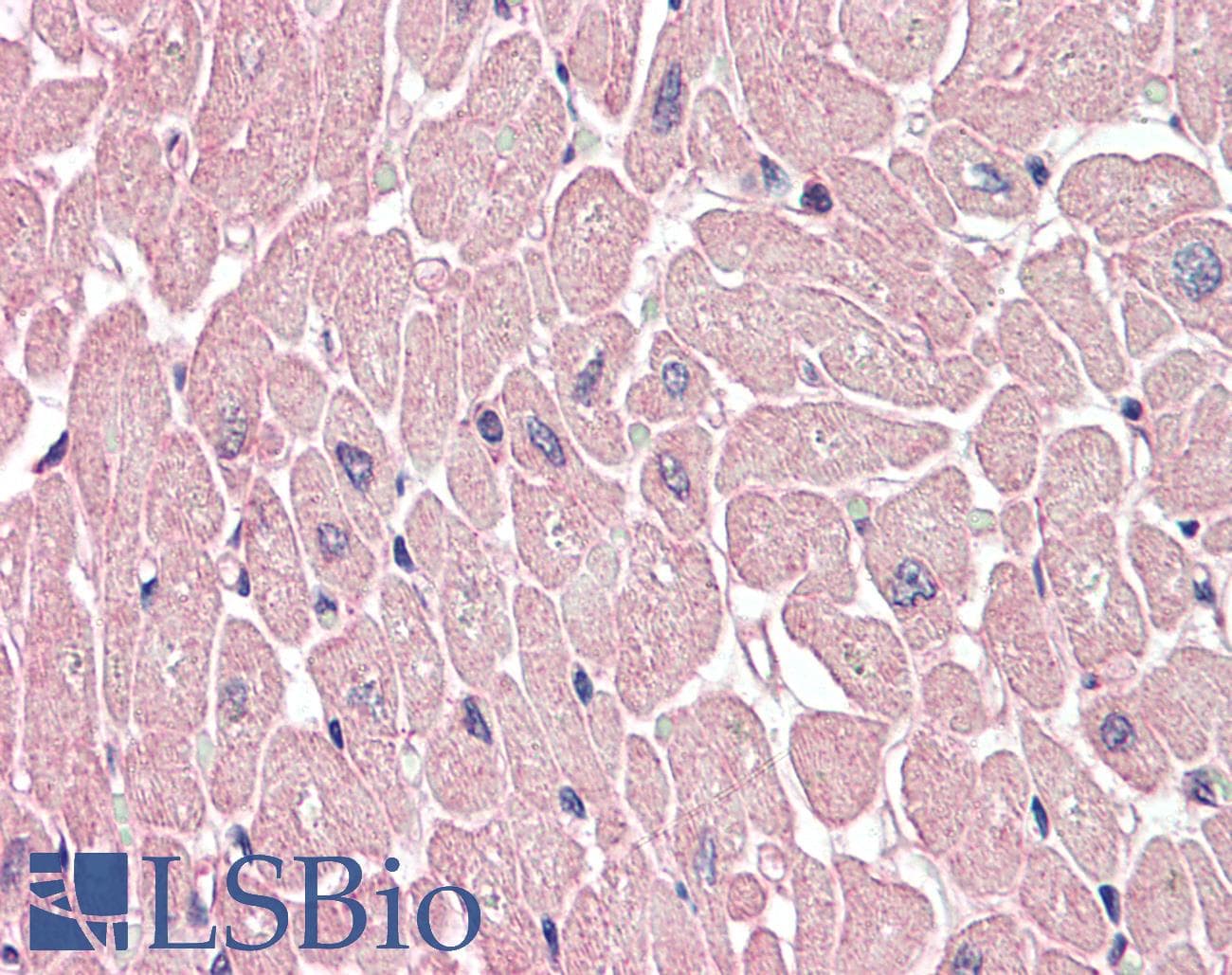 IHC-plus™ ARHGEF17 / TEM4 Antibody
