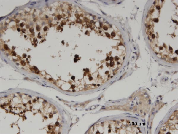Monoclonal Mouse anti-Human CKAP2 Antibody (clone 3H1, IHC, WB)