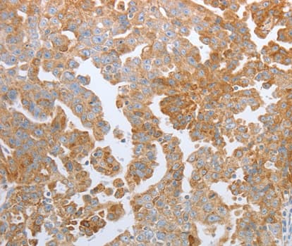 IHC-plus™ Polyclonal Rabbit anti-Human KISS1R / GPR54 Antibody (IHC, WB)