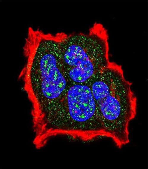 Polyclonal Rabbit anti-Human Tuberin / TSC2 Antibody (phospho-Ser1420, IF)