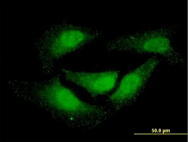 NR0B1 / DAX1 Antibody (clone 2F12)