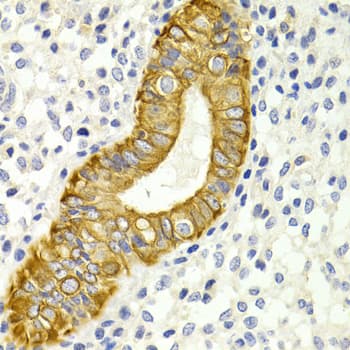 DRD4 / Dopamine Receptor D4 Antibody