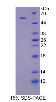 Human TGN46 / TGN38 Protein (Recombinant)