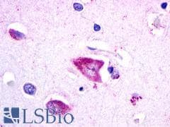 PathPlus™ GALR3 / Galanin Receptor 3 Antibody (Cytoplasmic Domain)