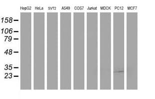 Monoclonal Mouse anti-Human SSR1 Antibody (clone OTI 5D5, WB)