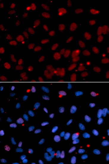 SRSF1 / SF2 Antibody