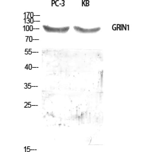 GPRIN1 / GRIN1 Antibody (200-280 aa, Internal)