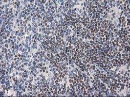 Monoclonal Mouse anti-Human ANKRD53 Antibody (clone OTI1E1, IHC, IF, WB)