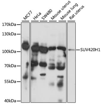 Polyclonal Rabbit anti-Human SUV420H1 Antibody (WB)