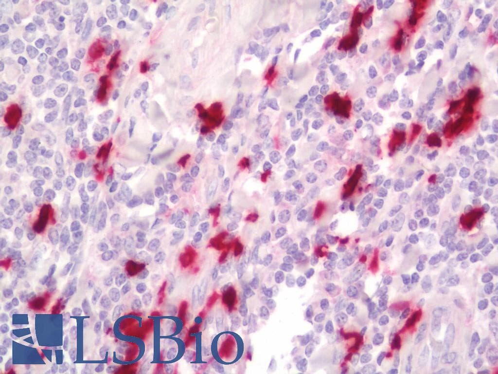 IHC-plus™ S100A9 / MRP14 Antibody