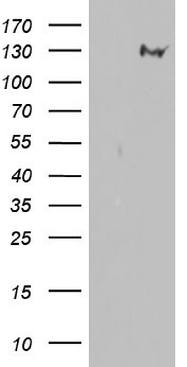 Monoclonal Mouse anti-Human GLI / GLI1 Antibody (clone OTI2E1, aa755-1106, IHC, WB)