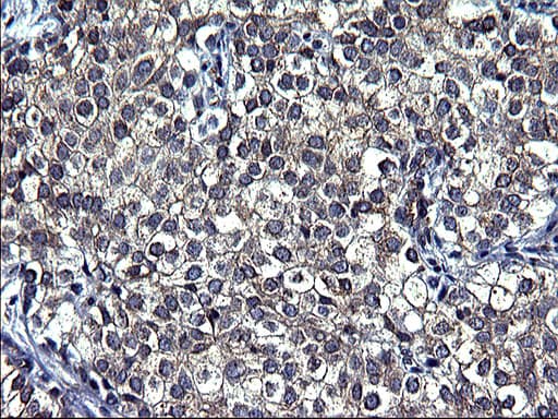 TUBA1A / Tubulin Alpha 1a Antibody (clone OTI2C8)