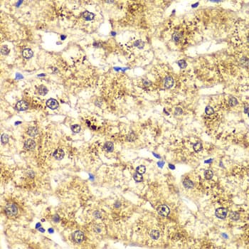 Polyclonal Rabbit anti-Human SPTLC1 / HSN1 Antibody (IHC, WB)