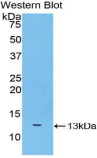 SLIT3 Antibody (aa453-516)