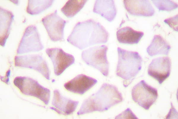 Polyclonal Rabbit anti-Human TNNI3 / Cardiac Troponin I Antibody (Gly136, IHC, IF, WB)